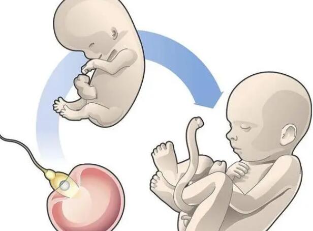 试管婴儿促排卵泡少，试管婴儿促排卵泡少怎么办