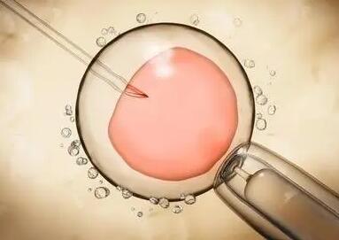 高龄试管注射排卵针促排后一次取多少个卵泡最合适